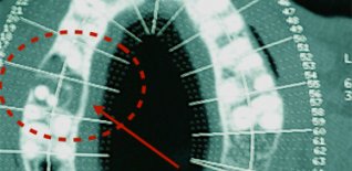 Prima del trattamento