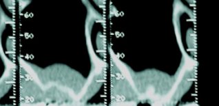 Prima del trattamento