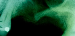 Prima del trattamento