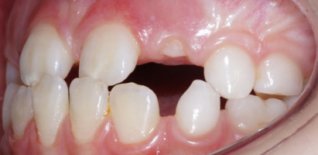 Prima del trattamento