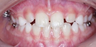 Risultato del trattamento