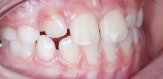 Risultato del trattamento