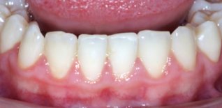 Risultato del trattamento