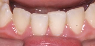 Prima del trattamento