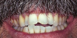 Prima del trattamento