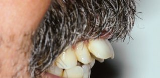 Prima del trattamento