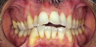 Prima del trattamento