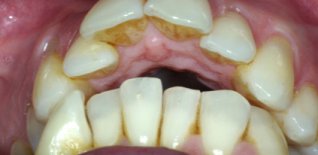 Prima del trattamento