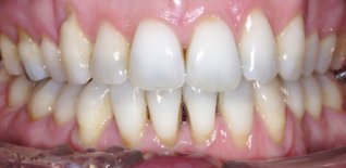 Risultato del trattamento