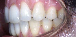 Risultato del trattamento