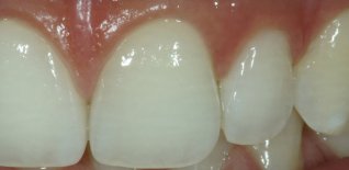 Particolare ceramica di sinistra