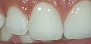 Particolare ceramica di destra