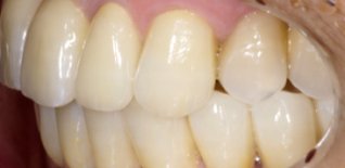 Risultato del trattamento