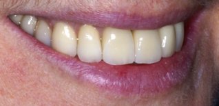 Risultato del trattamento